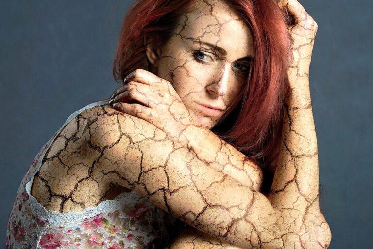 Fibromialgia: Un camino hacia la sanación